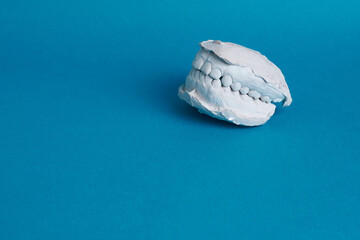 Study model dental impression teeth on blue background © ZaizStudio