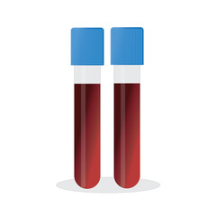 test tubes with blood and a container with urine