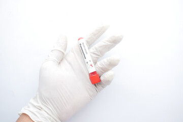hand in medical gloves holding blood test tube on white background 