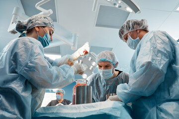 cosmetic liposuction surgery in actual operating room setting showing surgeons group during...