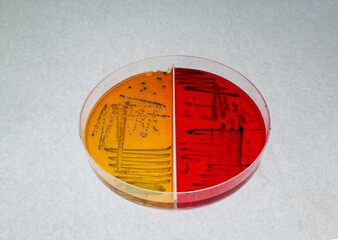 laboratory dish contain growth of colored bacterial colonies on differential agar media
