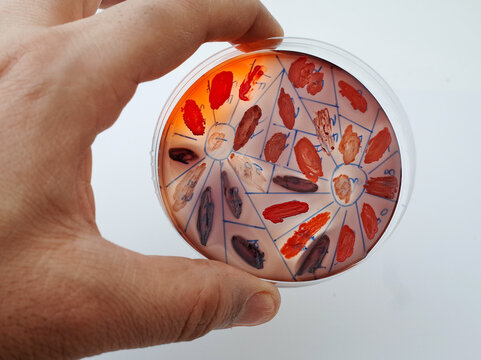 grwoth of different bacterial species on congo red agar plate to detect the ability of  the bacteria to produce biofilm