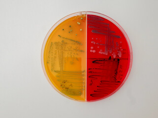 laboratory dish contain growth of colored bacterial colonies on differential agar media
