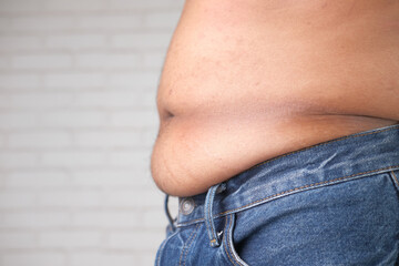 Naklejka premium young man with excessive belly fat, overweight concept