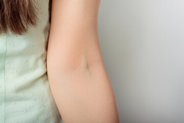 Close up photo of a womans arm vein over white background.