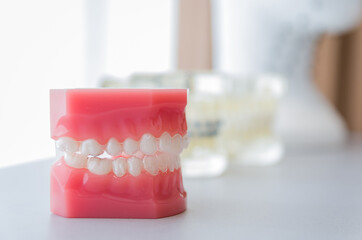 Dental model of invisible dental device to showcase to the custo