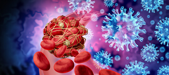 Blood clots and virus infection and Coronavirus or influenza as cells clumped together by sticky platelets and fibrin as a blockage in an artery or vein as a risk of clotting and clot concept