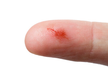 forefinger of the hand with a scratch and a drip of blood from a skin lesion close-up isolated on a white background.