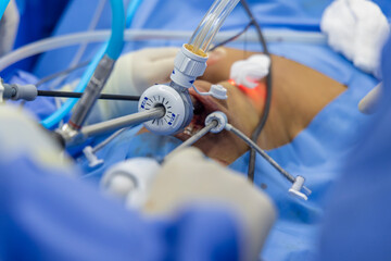 Shallow DOF with selective focus.Doctor in blue sterile surgical gown suite doing minimal invasive...