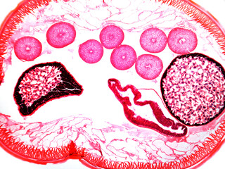 Cross section of ascartis.