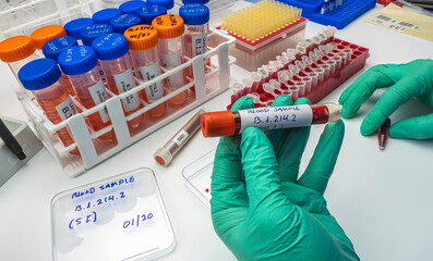 Laboratory analysis of a new Sars-Cov-2 mutation in Belgium from Congo, known as Spike Insertion...