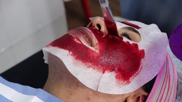 Mascarilla de sangre tratamiento facial