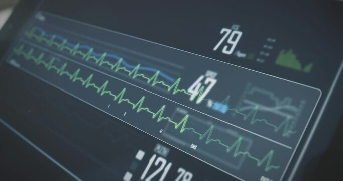 Healthcare professionals finger opens additional information on patients pulse on tablet screen with ECG, heart values.