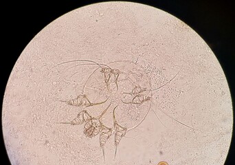 
Mite- Dermatophagoides farinae from light microscope, cause of allergy.