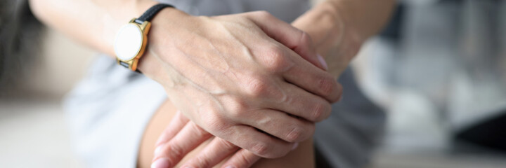 Female hands with wristwatch lying on knees closeup
