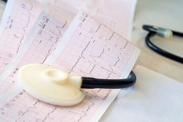 Stethoscope head tool lying on cardiogram clipped to pad closeup. concept of heart diseases and...