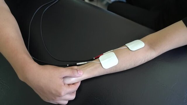 electrodes on female device on arm, female therapy, nerve stimu