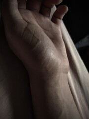 Sick hand with visible veins_Depression