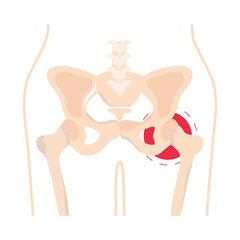 rheumatology pelvis bones