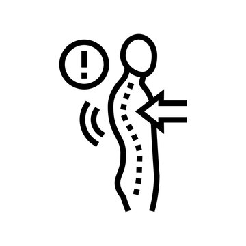 recommend clip art: kyphosis disease line icon vector. kyphosis disease sign. isolated contour symbol black illustration