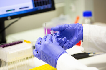Hands of a scientific researcher in blue gloves closing a small test tube in lab
