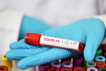 Obraz premium Blood sample tube positive with COVID-19 virus