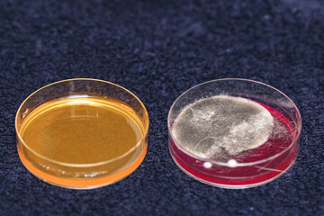 bacterial inoculation in laboratory dishes, grown colonies of bacteria or fungi