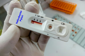 Rapid test cassette for Helicobacter Pylori (H. pylori) testing