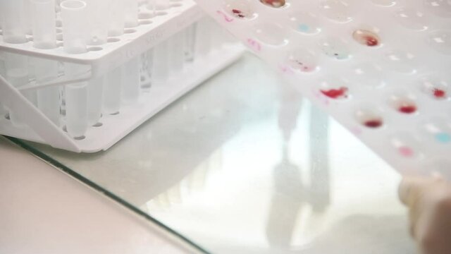 The doctor works with blood samples from donors