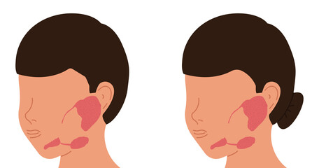 Localization of salivary glands in males and females. Medical vector illustration.