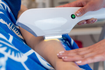 脱毛器で腕を脱毛しているシーン