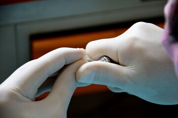 Dental preparation for zirconium coating treatment