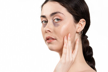 Portrait of a young beautiful woman with dark circles under her eyes. Isolated on a white background. The concept of beauty and skin care
