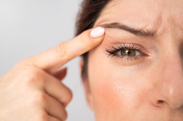 Close-up portrait of Caucasian middle-aged woman pointing to the wrinkles on the upper eyelid....