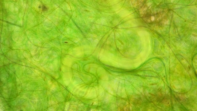 nematoda worm under a microscope, worm movement among algae, widely distributed on the ground, is a parasite, the exact form is not defined
