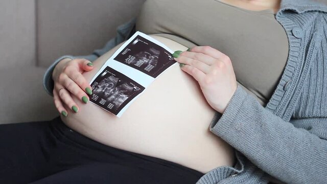 Pregnant woman lies on the couch and examines an ultrasound picture of her baby. The concept of the expectant mother is looking forward to her baby.