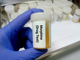Urine sample for morphine test, urine, drug test