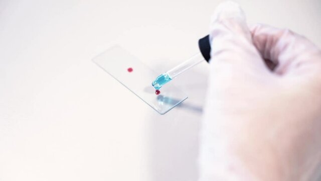 Slow motion: Hand steadily dripping blood out of a pipette onto small glass plate