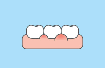 The white teeth with swollen gums disease illustration vector design on blue background. Dental care concept.