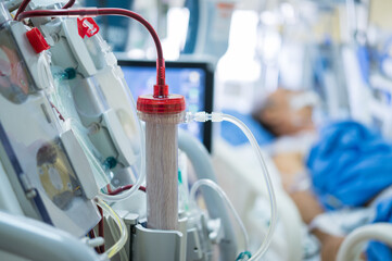 Dialysis machine is working. Acting as a substitute for the kidneys to drive waste from the body.