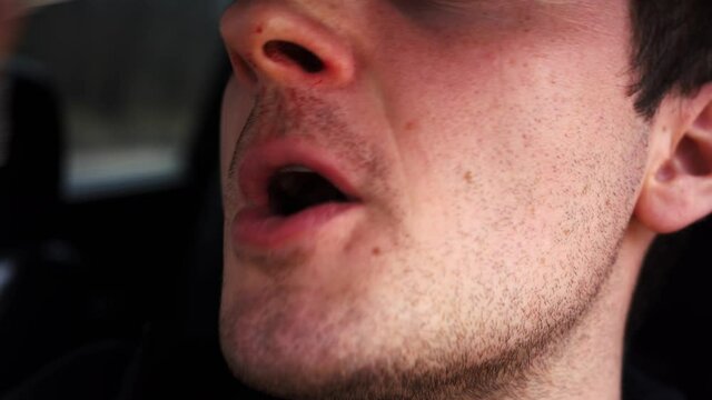 a man chooses a nosebleed on napkins