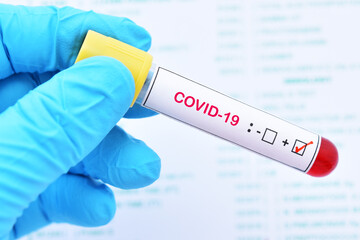 Fototapeta premium Blood sample tube positive with COVID-19 virus 