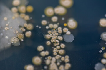 Backgrounds of Characteristics and Different shaped Colony of Bacteria and Mold growing on agar plates from Soil samples for education in Microbiology laboratory.

