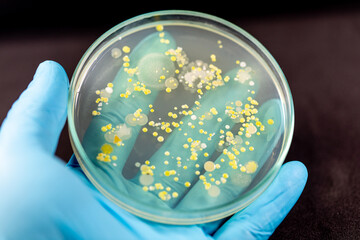 Backgrounds of Characteristics and Different shaped Colony of Bacteria and Mold growing on agar...