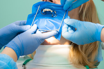 Dental treatment cofferdam in stomatology. Dentist using dental dam for tooth isolation.