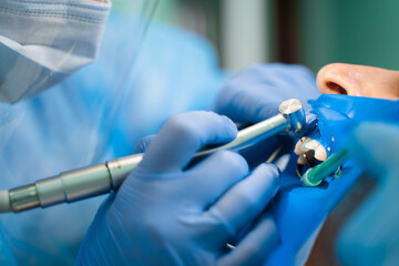 Dental treatment cofferdam in stomatology. Dentist using dental dam for tooth isolation.