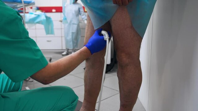 The doctor conducts ultrasound examination of the patient's legs. Methods of diagnosing varicose veins. The specialist checks the patient's veins. Phlebeurysm. Diseases of veins and their diagnosis
