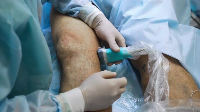The doctor on the operating table in the operating room with the help of the latest device uzd diagnoses varicose veins on the patient's leg. Foot disease, treatment with innovative methods