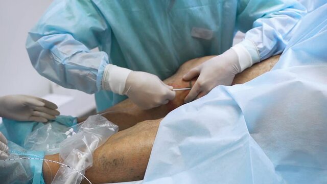 The doctor performs surgery on a patient with varicose veins with the help of modern technologies of a special laser and pushes a catheter with a long tube and a sensor into the patient's leg.