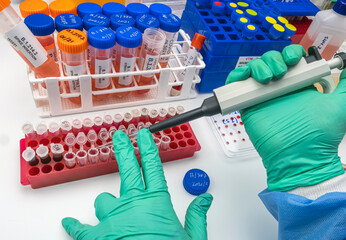 Laboratory analysis of a new Sars-Cov-2 mutation in Belgium from Congo, known as Spike Insertion...